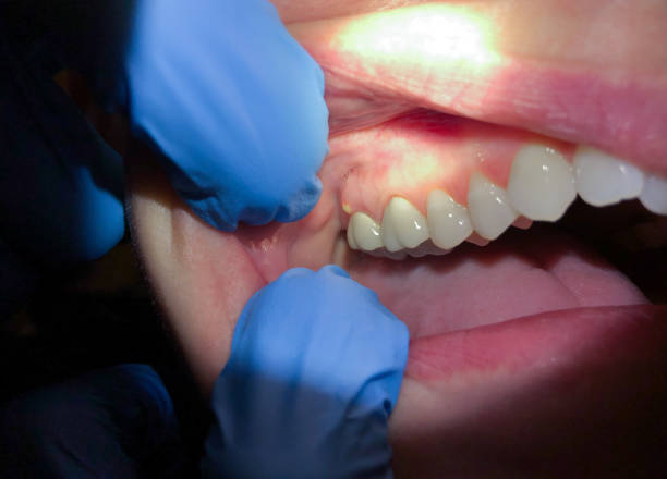Best 24-Hour Emergency Dentist in Poquoson, VA